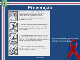 Sífilis TerciáriaSífilis não tratadas:Thiago de Souza16%37%Tegumentares10%SÍFILIS TERCIÁRIACardiovascularesFonte: http://scielo.unam.mx6%NeurossífilisLesão TegumentarFonte: http://mdsaude.com
