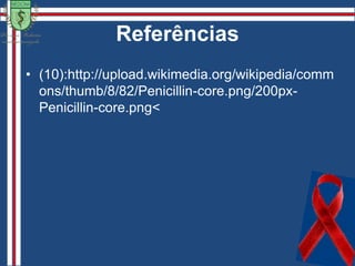  Atrofia ÓpticaIMAGEM: http://educacao.uol.com.br/biologia/ult1698u48.jhtm