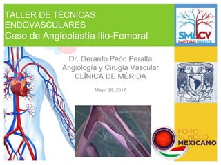 TALLER DE TÉCNICAS
ENDOVASCULARES
Caso de Angioplastía Ilio-Femoral
Dr. Gerardo Peón Peralta
Angiología y Cirugía Vascular
CLÍNICA DE MÉRIDA
Mayo 26, 2017
 