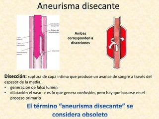 Aneurisma disecante
Ambas
corresponden a
disecciones
Disección: ruptura de capa intima que produce un avance de sangre a través del
espesor de la media.
• generación de falso lumen
• dilatación el vaso -> es lo que genera confusión, pero hay que basarse en el
proceso primario
 