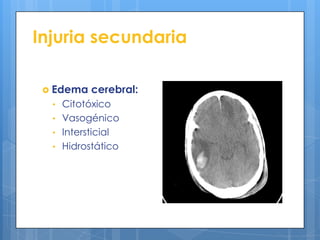 Injuria secundaria

  Edema   cerebral:
  • Citotóxico
  • Vasogénico
  • Intersticial
  • Hidrostático
 