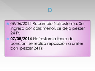  09/06/2014 Recambio Nefrostomía. Se 
ingresa por cáliz menor, se deja pezzer 
24 Fr. 
 07/08/2014 Nefrostomía fuera de 
posición, se realiza reposición a uréter 
con pezzer 24 Fr. 
 