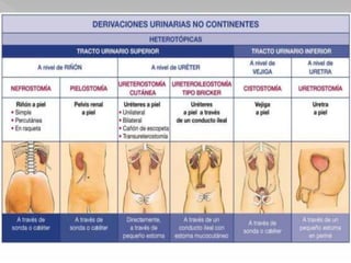 Caso clínico tuberculosis renal