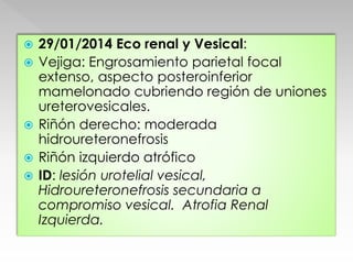  29/01/2014 Eco renal y Vesical: 
 Vejiga: Engrosamiento parietal focal 
extenso, aspecto posteroinferior 
mamelonado cubriendo región de uniones 
ureterovesicales. 
 Riñón derecho: moderada 
hidroureteronefrosis 
 Riñón izquierdo atrófico 
 ID: lesión urotelial vesical, 
Hidroureteronefrosis secundaria a 
compromiso vesical. Atrofia Renal 
Izquierda. 
 