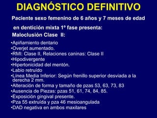 Caso Complejo De Ortodoncia | PPT