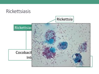 Rickettsiasis
Rickettsiaceae
Rickettsia
Coxiella
Erlichia
Cocobacilos GN con vector
Intracelulares NO vector,
rash,
vasculitis
 