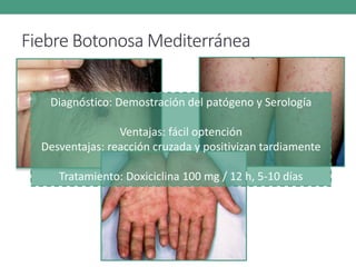 Fiebre Botonosa Mediterránea
Diagnóstico: Demostración del patógeno y Serología
Ventajas: fácil optención
Desventajas: reacción cruzada y positivizan tardiamente
Tratamiento: Doxiciclina 100 mg / 12 h, 5-10 días
 