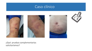 Caso clínico
¿Qué pruebas complementarias
solicitaríamos?
 