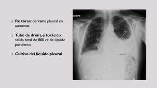 o Rx tórax: derrame pleural en
aumento.
o Tubo de drenaje torácico:
salida total de 800 cc de líquido
purulento.
o Cultivo del líquido pleural
 
