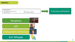 13
30/04/21
Neoplasia
LES
Endocarditis Infecciosa
Enf. Whipple
4 semanas ceftriaxona
 