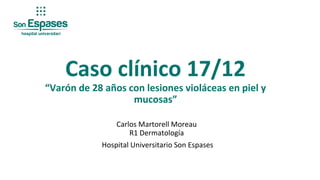 Carlos Martorell Moreau
R1 Dermatología
Hospital Universitario Son Espases
Caso clínico 17/12
“Varón de 28 años con lesiones violáceas en piel y
mucosas”
 