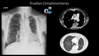 Pruebas Complementarias
 