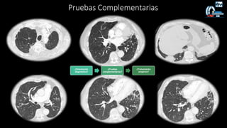 Pruebas Complementarias
¿Orientación
diagnóstica?
¿Pruebas
complementarias?
¿Tratamiento
empírico?
 