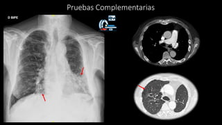 Pruebas Complementarias
 