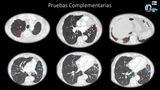 Pruebas Complementarias
 