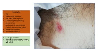 Serologías
• VIH
• Treponema pallidum,
• VHC,VHA,VHB negativo,
• Chlamydophila psittaci y
penumoniae
• Mycoplasma pneumoniae
Coxiella Burnetti IgM e IgG.
• Borrelia burdgoferi.
• Brucella melitensis.
• CMV IgG posiavo.
• Ricke[sia conorii IgM posivo,
IgG 1/640
 