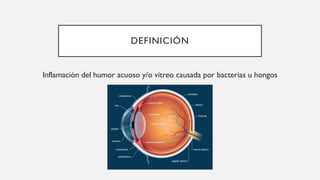 DEFINICIÓN
Inflamación del humor acuoso y/o vítreo causada por bacterias u hongos
 