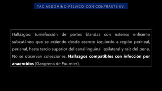 Hallazgos: tumefacción de partes blandas con extenso enfisema
subcutáneo que se extiende desde escroto izquierdo a región perineal,
perianal, hasta tercio superior del canal inguinal ipsilateral y raíz del pene.
No se observan colecciones. Hallazgos compatibles con infección por
anaerobios (Gangrena de Fournier).
TA C A B D OM I N O - P É LV I C O C ON C ON T RA S T E E V.
 