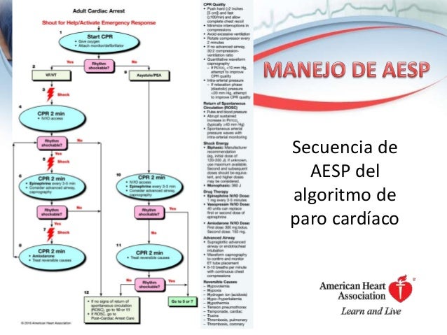 Caso de actividad electrica sin pulso