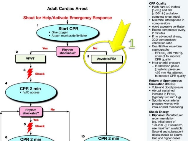 Caso de actividad electrica sin pulso