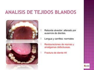 

Reborde alveolar: alterado por
ausencia de dientes.



Lengua y carrillos: normales



Restauraciones de resinas y
amalgamas defectuosas.



Fractura de diente 44

 