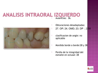

Ausencias: 36.



Obturaciones desadaptadas:



27. OP; 24. OMD; 23. DP ; 22M



clasificacion de angle: no
aplicable



Mordida borde a borde:28 y 38



Perdia de la integridad del
esmalte en oclusal: 28

 
