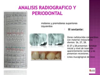 molares y premolares superiores
izquierdos


III sextante:



Zonas radiolucidas compatibles
con material restaurativo
dientes 26, 27, 28.



El 27 y 28 presentan Sondaje
inicial y nivel de inserción
aparentemente normal y no
presentan recesiones



Linea mucogingival de 3mm

 