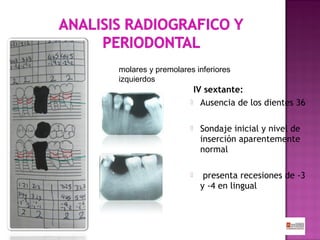 molares y premolares inferiores
izquierdos

IV sextante:
 Ausencia de los dientes 36


Sondaje inicial y nivel de
inserción aparentemente
normal



presenta recesiones de -3
y -4 en lingual

 