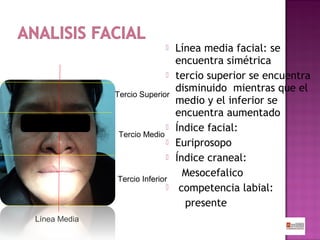 



Tercio Superior

Tercio Medio





Tercio Inferior


Línea Media

Línea media facial: se
encuentra simétrica
tercio superior se encuentra
disminuido mientras que el
medio y el inferior se
encuentra aumentado
Índice facial:
Euriprosopo
Índice craneal:
Mesocefalico
competencia labial:
presente

 