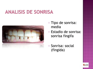 o
o

o

Tipo de sonrisa:
media
Estadio de sonrisa:
sonrisa fingifa
Sonrisa: social
(fingida)

 