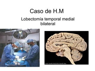 Caso de H.M Lobectomía temporal medial bilateral 