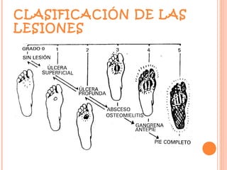 CLASIFICACIÓN DE LAS
LESIONES
 
