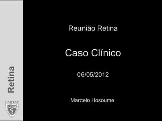 Reunião Retina


         Caso Clínico
Retina




            06/05/2012



          Marcelo Hosoume
 