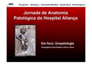 Jornada de Anatomia
Patológica do Hospital Aliança




            Em foco: Uropatologia
            Patologista Celso Rubens Vieira e Silva
 