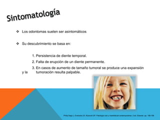 Caso finalizado | PPTX