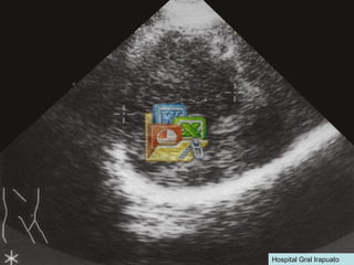 Hospital Gral Irapuato 