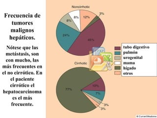 Frecuencia de tumores malignos hepáticos. Nótese que las metástasis, son con mucho, las más frecuentes en el no cirrótico. En el paciente cirrótico el hepatocarcinoma es el más frecuente. tubo digestivo pulmón  urogenital  mama  hígado  otros 