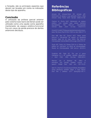 e fonação, são os principais aspectos que
devem ser levados em conta na indicação
deste tipo de aparelho.
	
Conclusão
A utilização da prótese parcial anterior
pelo sistema tubo-barra de Denari pode ser
utilizado como uma opção como aparelho
mantenedor de espaço estético-funcional
fixo em casos de perda precoce de dentes
anteriores decíduos.
Referências
Bibliográficas
 
Almeida RR, Almeida-Pedrin RR, Almeida MR.
Mantenedor de espaço e sua aplicação clínica. J Bras
Ortodon Ortop Facial 2003 mar-abr; 8(44):157-66.
Cardoso M, Rocha MJC. Mantenedor de espaço
estético: uma solução para dentes decíduos
traumatizados. Rev Ibero-am Odontopediatr
Odontol Bebê 2004 nov-dez; 7(40):512-8.
DenariW,CorrêaD.Próteseparcialanteriorpelosistematubo-
barra. Rev Assoc Paul Cir Dent 1995 nov-dez; 49(6):477-8
Diniz MB, Silva RC, Zuanon ACC. Perda dental
precoce e manutenção de espaço na dentadura
decídua: relato de um caso clínico. Rev Ibero-am
Odontopediatr Odontol Bebê 2005 jul-ago; 8(44):376-81.
Giuzio MC, Ferraz LM, Ferreira SLM et al. Prótese fixa
anterior em “cant-lever” na clínica de odontopediatria.
Revista de Odontopediatria 1993 abr-jun; 3(2):83-9.
Qudeimat MA, Fayle AS. The use of space
maintainers at a UK pediatric dentistry department.
J Dent Child 1999 Nov-Dez; 66(6):383-6.
Riekman GA, el Badrawy HE. Effect of
premature loss primary maxillary incisors on
speech. Pediatr Dent 1985 Jun; 7(2):119-22.
Saini S1, Sharma D. Functional and Esthetic Rehabilitation
during Deciduous Dentition Stage: A Case Report.
Dent Res J (Isfahan). 2011 Spring;8(2):108-11.
 