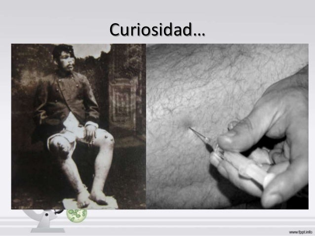 El tratamiento de la cirrosis del hígado contra el alcoholismo