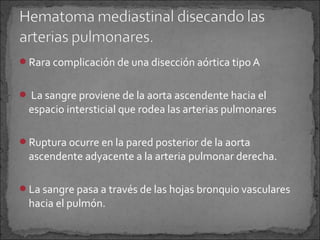 Rara complicación de una disección aórtica tipo A
 La sangre proviene de la aorta ascendente hacia el

espacio intersticial que rodea las arterias pulmonares

Ruptura ocurre en la pared posterior de la aorta

ascendente adyacente a la arteria pulmonar derecha.

La sangre pasa a través de las hojas bronquio vasculares

hacia el pulmón.

 