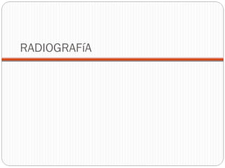RADIOGRAFíA 