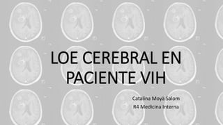 LOE CEREBRAL EN
PACIENTE VIH
Catalina Moyà Salom
R4 Medicina Interna
 