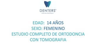 EDAD: 14 AÑOS
SEXO: FEMENINO
ESTUDIO COMPLETO DE ORTODONCIA
CON TOMOGRAFIA
 