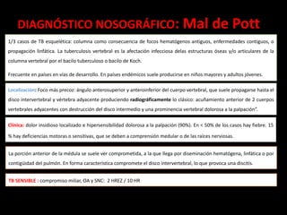 DIAGNÓSTICO NOSOGRÁFICO: Mal de Pott
1/3 casos de TB esquelética: columna como consecuencia de focos hematógenos antiguos, enfermedades contiguos, o
propagación linfática. La tuberculosis vertebral es la afectación infecciosa delas estructuras óseas y/o articulares de la
columna vertebral por el bacilo tuberculoso o bacilo de Koch.
Frecuente en países en vías de desarrollo. En países endémicos suele producirse en niños mayores y adultos jóvenes.
Localización: Foco más precoz: ángulo anterosuperior y anteroinferior del cuerpo vertebral, que suele propagarse hasta el
disco intervertebral y vértebra adyacente produciendo radiográficamente lo clásico: acuñamiento anterior de 2 cuerpos
vertebrales adyacentes con destrucción del disco intermedio y una prominencia vertebral dolorosa a la palpación”.
Clínica: dolor insidioso localizado e hipersensibilidad dolorosa a la palpación (90%). En < 50% de los casos hay fiebre. 15
% hay deficiencias motoras o sensitivas, que se deben a comprensión medular o de las raíces nerviosas.
La porción anterior de la médula se suele ver comprometida, a la que llega por diseminación hematógena, linfática o por
contigüidad del pulmón. En forma característica compromete el disco intervertebral, lo que provoca una discitis.
TB SENSIBLE : compromiso miliar, OA y SNC: 2 HREZ / 10 HR
 