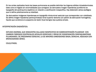 En los cortes realizados hacia las bases pulmonares es posible delimitar los órganos sólidos intraabdominales
tales como el hígado sin anormalidades que consignar; se demuestra imagen hiperdensa puntiforme en
topografía del parénquima esplénico en relación a calcificación inespecífica. Hay distensión aérea esofágica
que lo define prácticamente su totalidad.
Se demuestran imágenes hiperdensas en topografía intraluminal vesicular que corresponden con colelitiasis.
Se define imagen hipodensa parenquimatosa renal superior derecha con patrón de atenuación homogéneo,
líquido que condiciona la sospecha de lesión focal benigna tipo quística simple.
INTERPRETACIÓN DIAGNÓSTICA:  
ESTUDIO ANORMAL QUE DEMUESTRA HALLAZGO INESPECIFICO DE SOBREDISTENSIÓN PULMONAR  CON
CAMBIOS FIBROSOS CICATRICIALES APICALES DERECHOS Y ÁREAS DE CONDENSACIÓN PARENQUIMATOSAS
PULMONARES, DE PREDOMINIO DERECHO, LA DE MAYORES DIMENSIONES BASAL DERECHA, ASOCIADA CON
BRONCOGRAMA AÉREO.
COLELITIASIS.
 