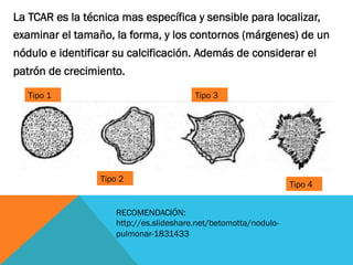 La TCAR es la técnica mas específica y sensible para localizar,
examinar el tamaño, la forma, y los contornos (márgenes) de un
nódulo e identificar su calcificación. Además de considerar el
patrón de crecimiento.
Tipo 1
Tipo 2
Tipo 3
Tipo 4
RECOMENDACIÓN:
http://es.slideshare.net/betomotta/nodulo-
pulmonar-1831433
 