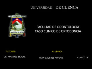 UNIVERSIDAD DE CUENCA
FACULTAD DE ODONTOLOGIA
CASO CLINICO DE ORTODONCIA
TUTORES:
DR. MANUEL BRAVO.
ALUMNO:
IVAN CACERES ALVEAR CUARTO “B”
 