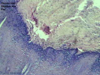 Fuente: Medina.2019
Tinción H&E
Objetivo 40x
Piel
 