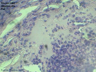 Fuente: Medina.2019
Tinción H&E
Objetivo 40x
Piel
 