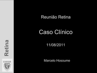 Reunião RetinaCaso Clínico11/08/2011 Marcelo Hosoume 